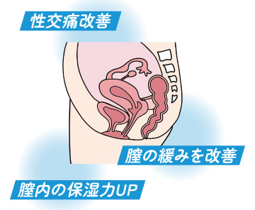 ヒアルロン酸注射