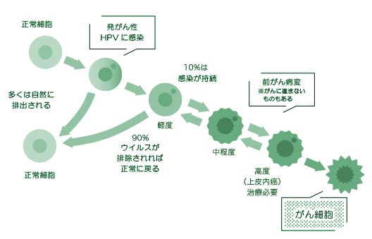 子宮頸がん