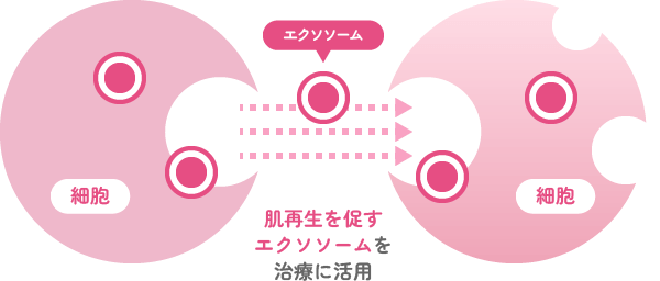 肌再生を促すエクソソームを治療に活用